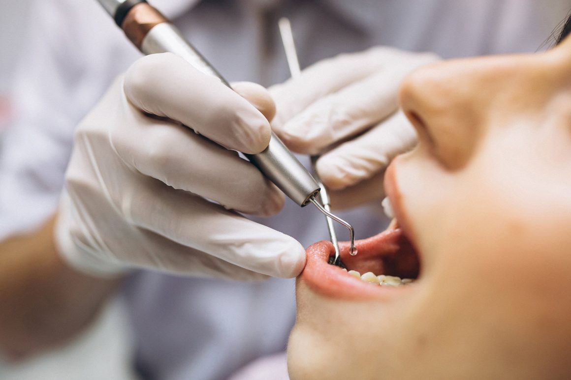 Dentist doing a dental filling treatment, thenorthmaindental.com