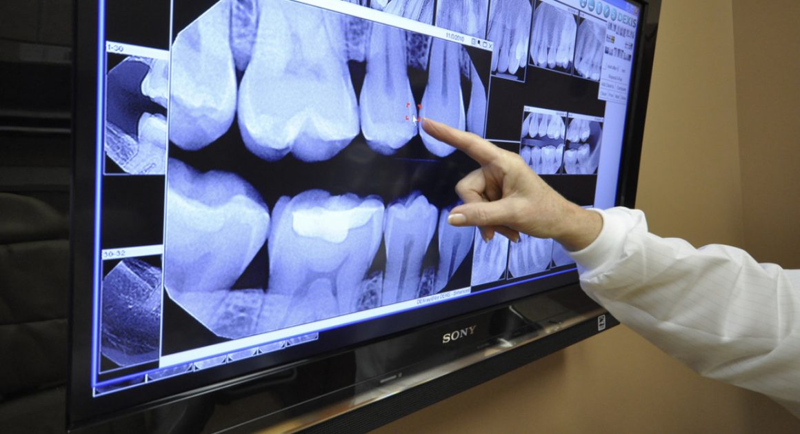 Digital dental X-ray, thenorthmaindental.com