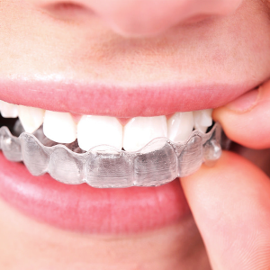 Invisalign Treatment at thenorthmaindental.com