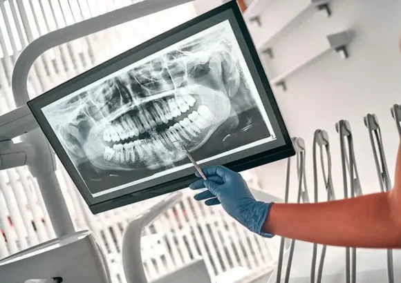 dental-xray, thenorthmaindental.com